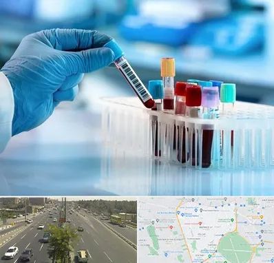 آزمایشگاه خون قبل از ازدواج در منطقه 17 تهران 