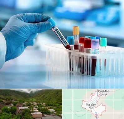 آزمایشگاه خون قبل از ازدواج در کلاله