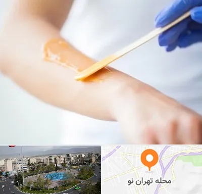 اپیلاسیون کار در تهران نو