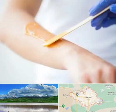 اپیلاسیون کار در مرند