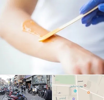 اپیلاسیون کار در چهارراه استانبول