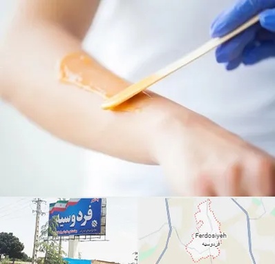 اپیلاسیون کار در فردوسیه شهریار