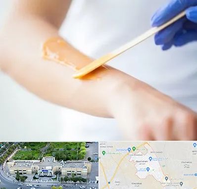 اپیلاسیون کار در نسیم شهر