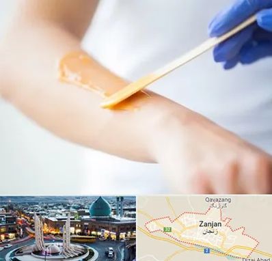 اپیلاسیون کار در زنجان