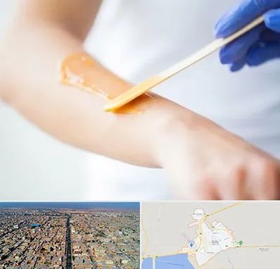 اپیلاسیون کار در بندر ماهشهر