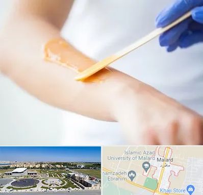 اپیلاسیون کار در ملارد