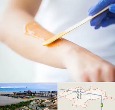اپیلاسیون کار در بندر ترکمن