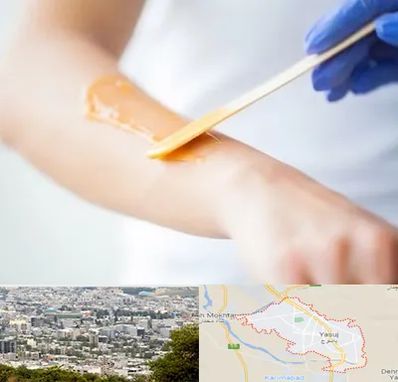 اپیلاسیون کار در یاسوج