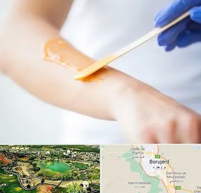 اپیلاسیون کار در بروجرد