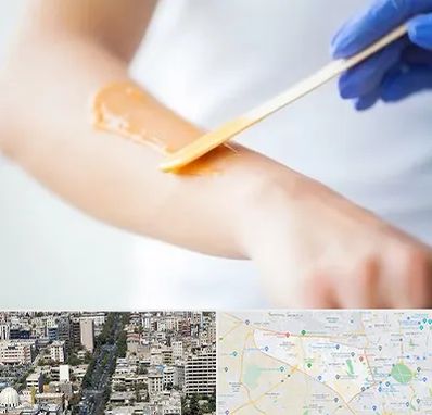 اپیلاسیون کار در منطقه 18 تهران 