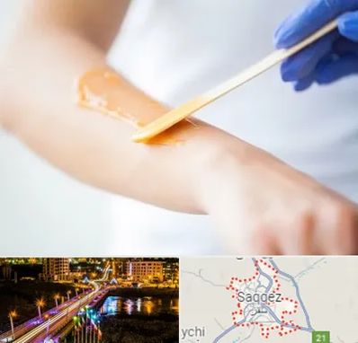 اپیلاسیون کار در سقز