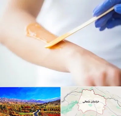اپیلاسیون کار در خراسان شمالی