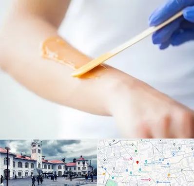 اپیلاسیون کار در میدان شهرداری رشت