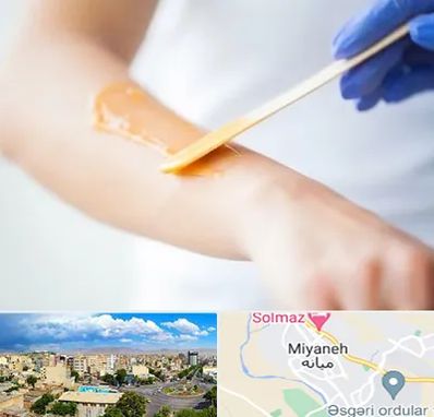 اپیلاسیون کار در میانه