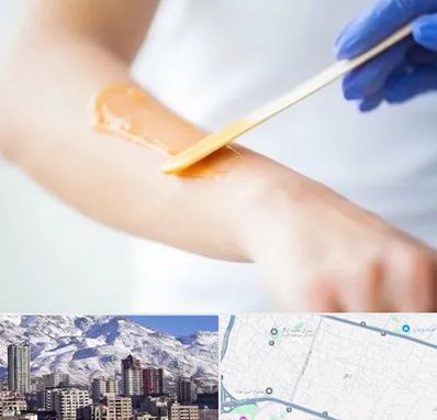 اپیلاسیون کار در ازگل