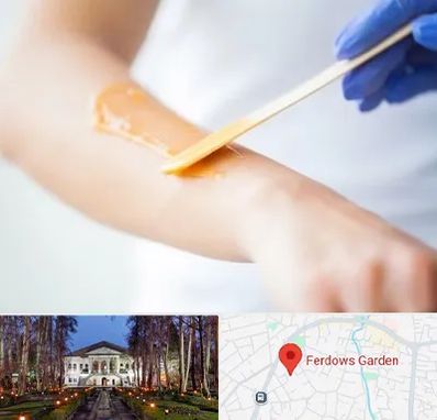 اپیلاسیون کار در باغ فردوس