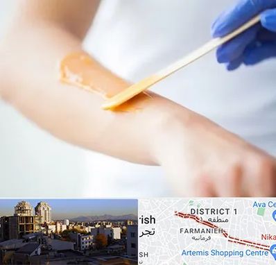 اپیلاسیون کار در فرمانیه 