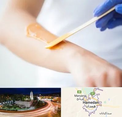 اپیلاسیون کار در همدان