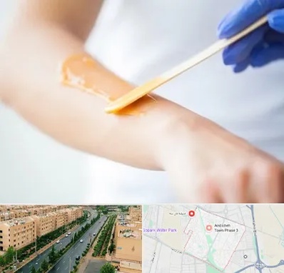 اپیلاسیون کار در فاز سه اندیشه