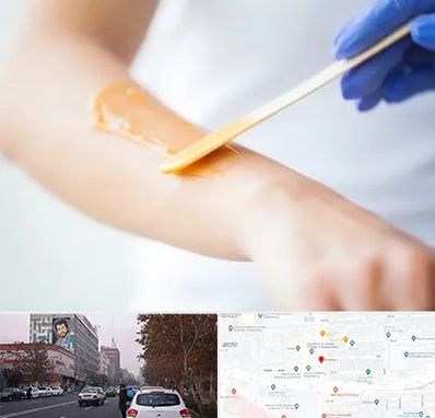 اپیلاسیون کار در کارگر شمالی 