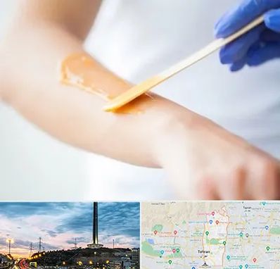 اپیلاسیون کار در منطقه 2 تهران 