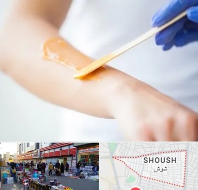 اپیلاسیون کار در شوش