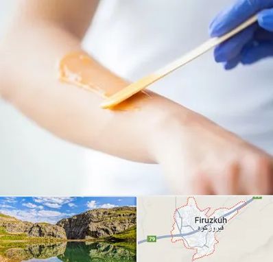 اپیلاسیون کار در فیروزکوه