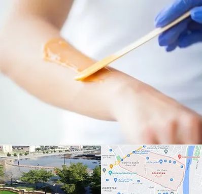 اپیلاسیون کار در گلستان اهواز