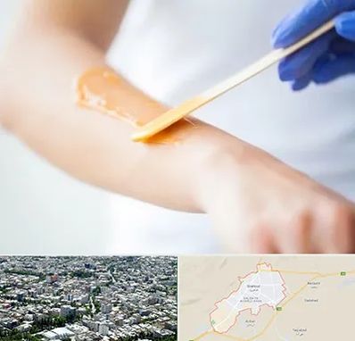 اپیلاسیون کار در شاهرود