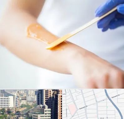 اپیلاسیون کار در خیابان بهشتی