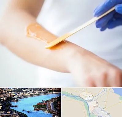 اپیلاسیون کار در خرمشهر