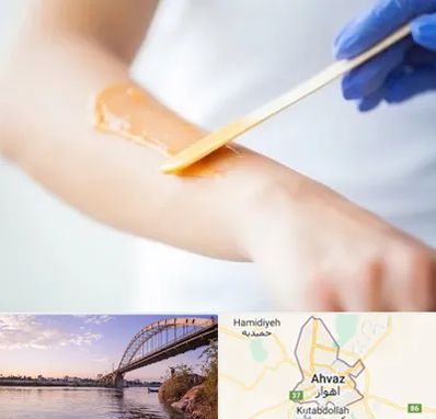 اپیلاسیون کار در اهواز