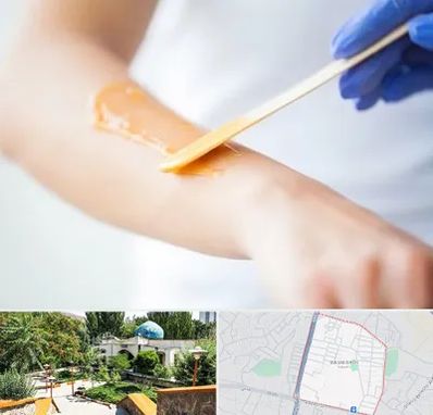 اپیلاسیون کار در باغمیشه تبریز