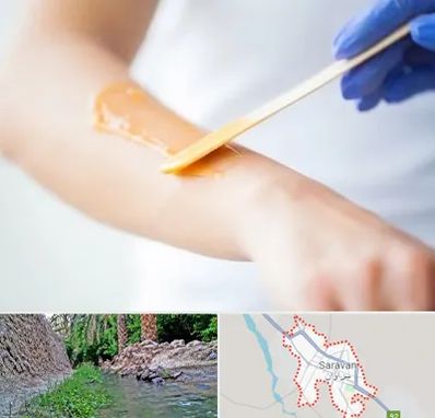 اپیلاسیون کار در سراوان