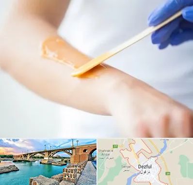 اپیلاسیون کار در دزفول