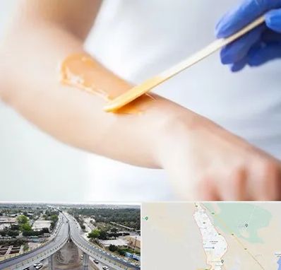 اپیلاسیون کار در اندیمشک