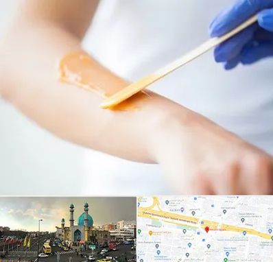 اپیلاسیون کار در رسالت 