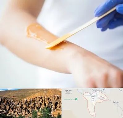 اپیلاسیون کار در اسکو