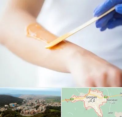 اپیلاسیون کار در گرگان