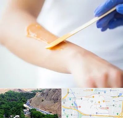 اپیلاسیون کار در کن 