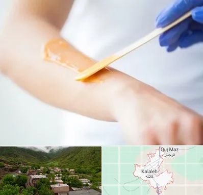 اپیلاسیون کار در کلاله