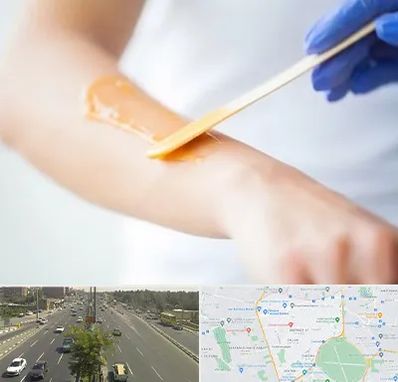 اپیلاسیون کار در منطقه 17 تهران 