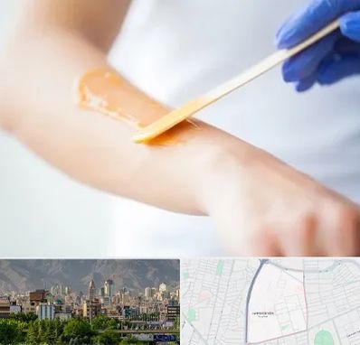 اپیلاسیون کار در جمشیدیه