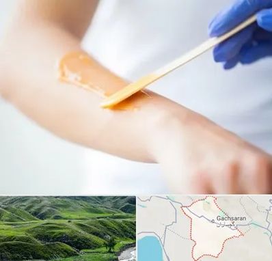 اپیلاسیون کار در گچساران