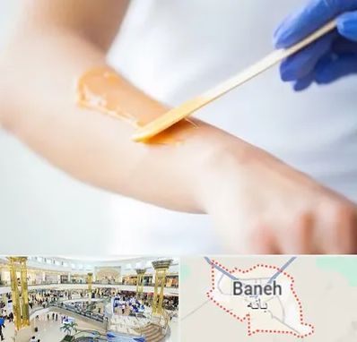 اپیلاسیون کار در بانه