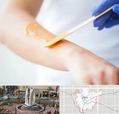 اپیلاسیون کار در زابل