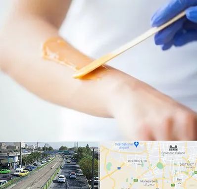 اپیلاسیون کار در جنوب تهران 