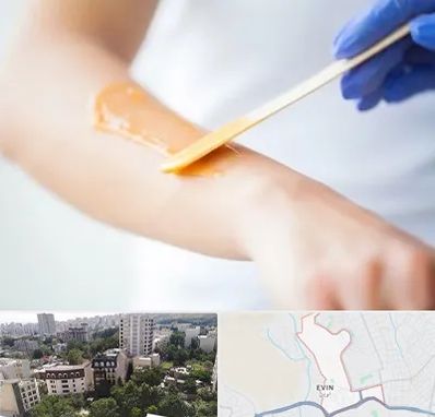 اپیلاسیون کار در اوین