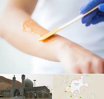 اپیلاسیون کار در شهرضا