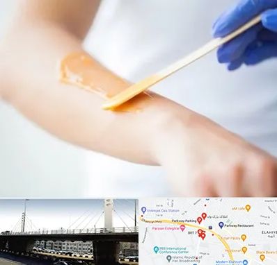 اپیلاسیون کار در پارک وی 